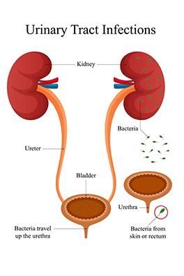 Shutterstock_2466297813-UTI-264x396