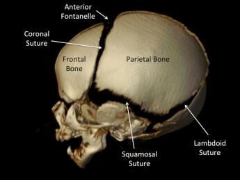 Parietal+Bone-345