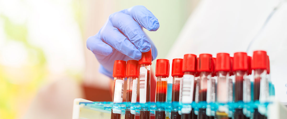 New study identifies potential biomarker for future treatment of HIE