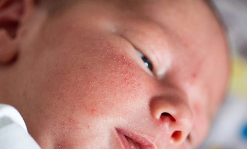 shutterstock_2356886919-500x302