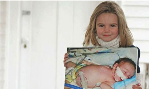 related content image