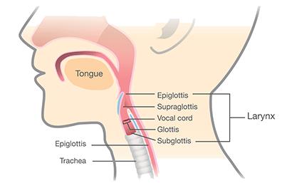 Shutterstock_420661489-Pediatric-laryngeal-stenosis-396x264